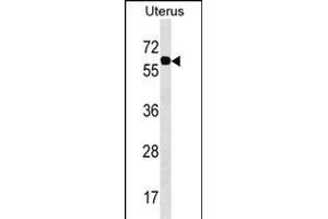 PGM3 Antibody (Center) (ABIN1538149 and ABIN2850274) western blot analysis in Uterus tissue lysates (35 μg/lane). (Phosphoglucomutase 3 Antikörper  (AA 237-263))