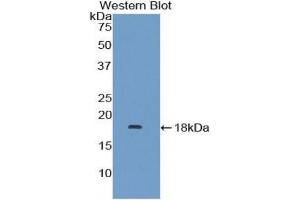 Western blot analysis of recombinant Human MAPKSP1.