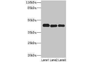 Western blot All lanes: PPME1 antibody at 2 μg/mL Lane 1: A549 whole cell lysate Lane 2: Hela whole cell lysate Lane 3: Mouse brain tissue Secondary Goat polyclonal to rabbit IgG at 1/10000 dilution Predicted band size: 43, 23, 19, 44 kDa Observed band size: 43 kDa (PPME1 Antikörper  (AA 201-386))