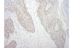 Immunohistochemistry (IHC) image for anti-DEAD (Asp-Glu-Ala-Asp) Box Polypeptide 21 (DDX21) (C-Term) antibody (ABIN7448516) (DDX21 Antikörper  (C-Term))