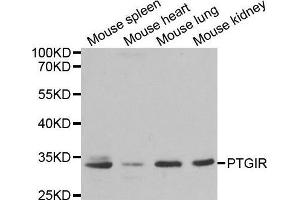 Western blot analysis of extracts of various cell lines, using PTGIR antibody. (Prostacyclin Receptor Antikörper  (AA 207-386))