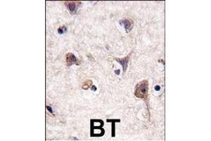 Formalin-fixed and paraffin-embedded human brain tissue reacted with Autophagy LC3 Antibody (G8a) (N-term), which was peroxidase-conjugated to the secondary antibody, followed by DAB staining. (MAP1LC3A Antikörper  (N-Term))