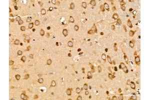 ABIN7094837 and ABIN7098888 at 1/100 staining Rat brain tissue by IHC-P. (SUCLG1 Antikörper  (N-Term))