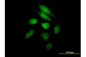 Immunofluorescence of purified MaxPab antibody to PER1 on HeLa cell. (PER1 Antikörper  (AA 1-1290))