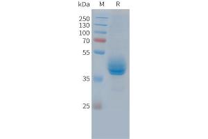 SDS-PAGE (SDS) image for CD3 epsilon (CD3E) (AA 22-117) protein (Fc Tag) (ABIN7538171)