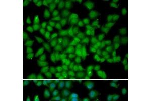 Immunofluorescence analysis of HeLa cells using CDKN2C Polyclonal Antibody (CDKN2C Antikörper)