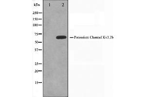 Western blot analysis on HepG2 cell lysate using KCNC2 Antibody,The lane on the left is treated with the antigen-specific peptide. (KCNC2 Antikörper  (C-Term))