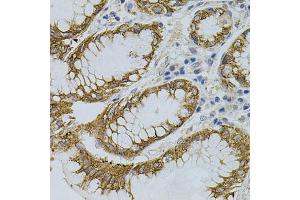 Immunohistochemistry of paraffin-embedded human stomach using SIGMAR1 antibody (ABIN5973191) (40x lens). (SIGMAR1 Antikörper)