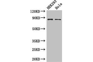 Western Blot Positive WB detected in: HEK293 whole cell lysate, Hela whole cell lysate All lanes: MLH1 antibody at 3 μg/mL Secondary Goat polyclonal to rabbit IgG at 1/50000 dilution Predicted band size: 85, 59, 74 kDa Observed band size: 85 kDa (MLH1 Antikörper  (AA 350-519))