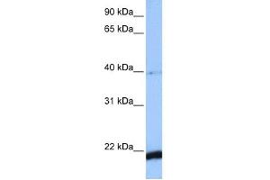 WB Suggested Anti-HBS1L Antibody Titration: 0. (HBS1L Antikörper  (C-Term))