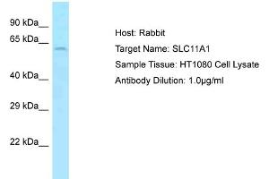 Host: Rabbit Target Name: SLC11A1 Sample Type: HT1080 Whole Cell lysates Antibody Dilution: 1. (SLC11A1 Antikörper  (Middle Region))