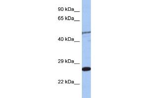 WB Suggested Anti-MIS12 Antibody Titration: 0. (MIS12 Antikörper  (Middle Region))