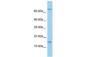 Host: Rabbit Target Name: RPL36AL Sample Type: Hela Whole Cell lysates Antibody Dilution: 1. (RPL36AL Antikörper  (C-Term))