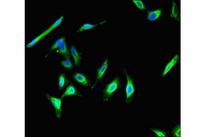 Immunofluorescent analysis of Hela cells using ABIN7146292 at dilution of 1:100 and Alexa Fluor 488-congugated AffiniPure Goat Anti-Rabbit IgG(H+L) (CIB2 Antikörper  (AA 65-164))