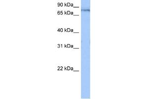 WB Suggested Anti-TTC14 Antibody Titration:  0. (TTC14 Antikörper  (N-Term))