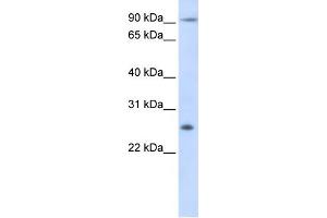 WB Suggested Anti-TSPAN31 Antibody Titration:  0. (TSPAN31 Antikörper  (Middle Region))