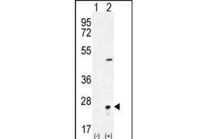 Western blot analysis of VSNL1 (arrow) using rabbit polyclonal VSNL1 Antibody (Center) (ABIN656135 and ABIN2845474). (VSNL1 Antikörper  (AA 47-75))