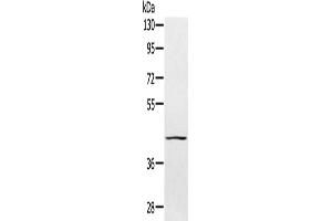 Gel: 8 % SDS-PAGE, Lysate: 40 μg, Lane: 231 cells, Primary antibody: ABIN7130778(PTPN7 Antibody) at dilution 1/300, Secondary antibody: Goat anti rabbit IgG at 1/8000 dilution, Exposure time: 1 minute (PTPN7 Antikörper)
