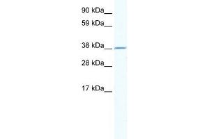 Human Thymus; WB Suggested Anti-RNF130 Antibody Titration: 2. (RNF130 Antikörper  (N-Term))