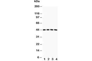 Western blot testing of SIRT3 antibody and Lane 1:  rat spleen;  2: human placenta;  3: HeLa;  4: COLO320 (SIRT3 Antikörper  (AA 66-399))