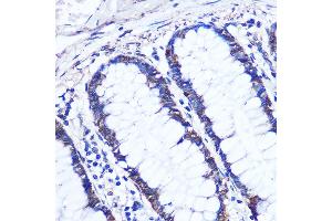 Immunohistochemistry of paraffin-embedded Human colon using OTUD7B Rabbit pAb (ABIN7269125) at dilution of 1:100 (40x lens). (OTUD7B Antikörper  (AA 530-700))