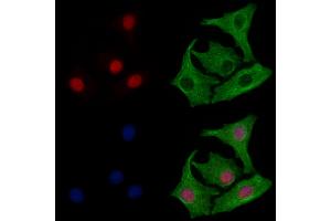 ABIN6264007 and ABIN6277984 staining Hela cells by IF/ICC. (Poly(A) Binding Protein, Cytoplasmic, Pseudogene 2 (PABPCP2) (C-Term) Antikörper)