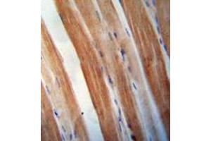 Immunohistochemistry analysis in formalin fixed and paraffin embedded human skeletal muscle reacted with KBTBD5 Antibody (Center) followed which was peroxidase conjugated to the secondary antibody and followed by DAB staining.