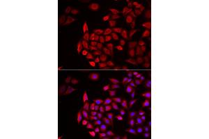 Immunofluorescence analysis of HeLa cells using COCH antibody (ABIN6132126, ABIN6138819, ABIN6138820 and ABIN6222234). (COCH Antikörper  (AA 20-260))