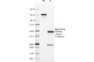 SDS-PAGE Analysis Purified HLA-DQ Mouse Monoclonal Antibody (SPV-L3). (HLA DQ Antikörper)