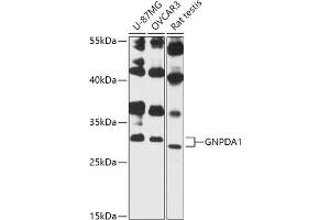 Western blot analysis of extracts of various cell lines, using GNPD antibody (3717) at 1:3000 dilution. (GNPDA1 Antikörper  (AA 1-70))