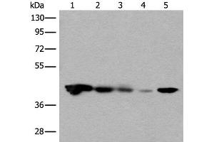 Western blot analysis of Jurkat HEPG2 and Hela cell Human testis tissue 231 cell lysates using CECR5 Polyclonal Antibody at dilution of 1:650 (CECR5 Antikörper)