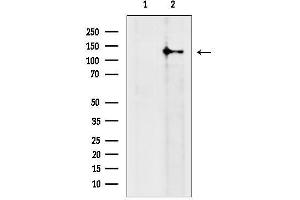 anti-Ras Protein-Specific Guanine Nucleotide-Releasing Factor 2 (RASGRF2) (N-Term) antibody
