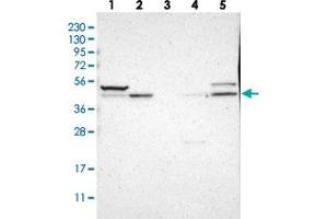 Western blot analysis of Lane 1: RT-4, Lane 2: U-251 MG, Lane 3: Human Plasma, Lane 4: Liver, Lane 5: Tonsil with SOX7 polyclonal antibody . (SOX7 Antikörper)