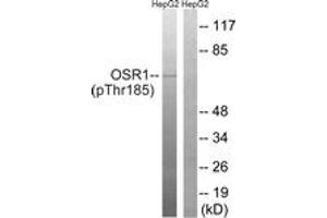 Western blot analysis of extracts from HepG2 cells treated with serum 20% 15', using OSR1 (Phospho-Thr185) Antibody. (OSR1 Antikörper  (pThr185))