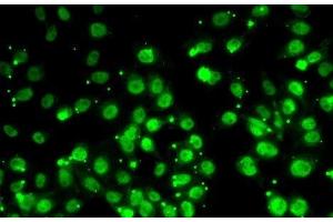 Immunofluorescence analysis of MCF7 cells using QKI Polyclonal Antibody (QKI Antikörper)