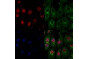 ABIN6263919 and ABIN6274026 staining Hela cells by IF/ICC.