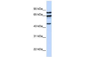 PPP4R2 antibody used at 1 ug/ml to detect target protein. (PPP4R2 Antikörper  (C-Term))
