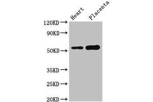 Western Blot Positive WB detected in: Mouse heart tissue, Human placenta tissue All lanes: DOK3 antibody at 3 μg/mL Secondary Goat polyclonal to rabbit IgG at 1/50000 dilution Predicted band size: 54, 24, 36, 25 kDa Observed band size: 54 kDa (DOK3 Antikörper  (AA 1-146))