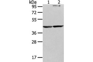 Western Blotting (WB) image for anti-WW Domain Containing Oxidoreductase (WWOX) antibody (ABIN5962023) (WWOX Antikörper)