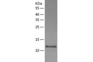 WWC1 Protein (AA 655-783) (His tag)