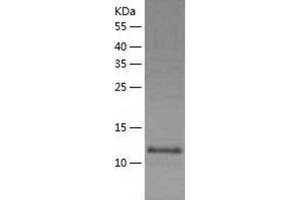 WWC1 Protein (AA 655-783) (His tag)