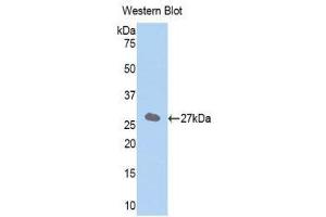 Western Blotting (WB) image for anti-Solute Carrier Family 27 (Fatty Acid Transporter), Member 5 (SLC27A5) (AA 471-689) antibody (ABIN1858807) (SLC27A5 Antikörper  (AA 471-689))