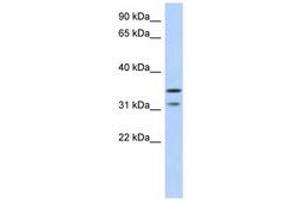 Retinoic Acid Induced 12 (RAI12) (AA 143-192) Antikörper