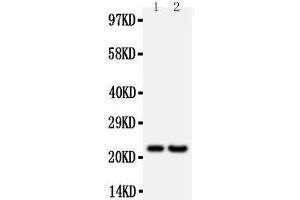 Anti-FGF9 antibody, Western blotting All lanes: Anti FGF9  at 0. (FGF9 Antikörper  (Middle Region))