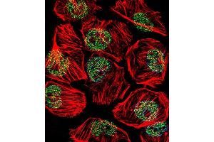 Fluorescent confocal image of  cell stained with TBP Antibody (Center) (ABIN390631 and ABIN2840935). (TBP Antikörper  (AA 210-239))