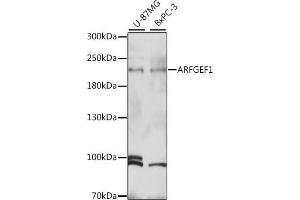 Western blot analysis of extracts of various cell lines, using  antibody (ABIN7265487) at 1:1000 dilution.