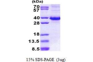 FBXO6 Protein (AA 1-293) (His tag)