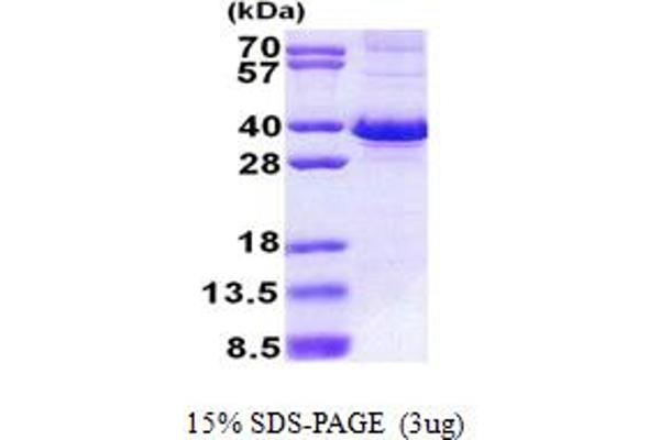 FBXO6 Protein (AA 1-293) (His tag)