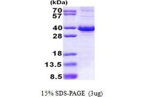 SDS-PAGE (SDS) image for F-Box Protein 6 (FBXO6) (AA 1-293) protein (His tag) (ABIN5853043) (FBXO6 Protein (AA 1-293) (His tag))