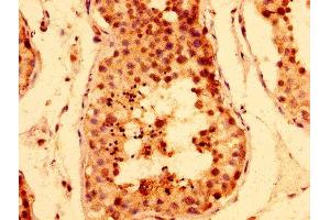 IHC image of ABIN7171496 diluted at 1:400 and staining in paraffin-embedded human testis tissue performed on a Leica BondTM system. (TNKS Antikörper  (AA 35-130))